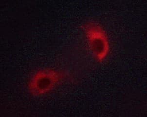 p56lck / LCK Antibody (phospho-Tyr393)