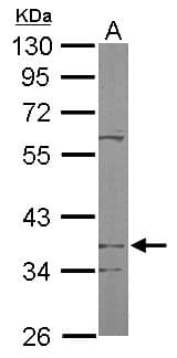 IHC-plus™ Polyclonal Rabbit anti-Human PDSS2 / DLP1 Antibody (aa88-351, IHC, WB)