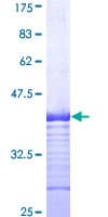 Human SLC11A2 / DMT1 Protein (Recombinant GST, N-terminus)