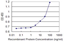 ALDH3B1 Antibody (clone 1F2)