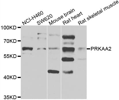 PRKAA2 / AMPK Alpha 2 Antibody