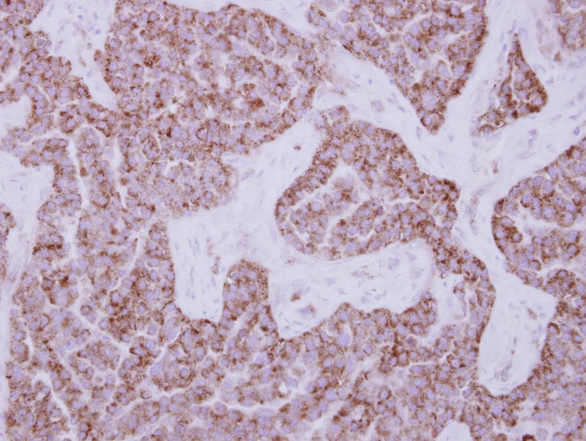 DUS2 / DUS2L Antibody