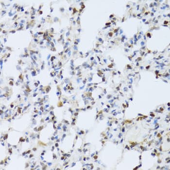 Polyclonal Rabbit anti-Human MAPK3 / ERK1 Antibody (IHC, IF, WB)
