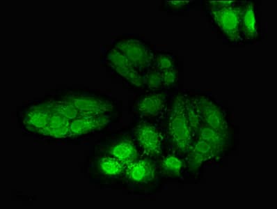 POLH / DNA Polymerase Eta Antibody