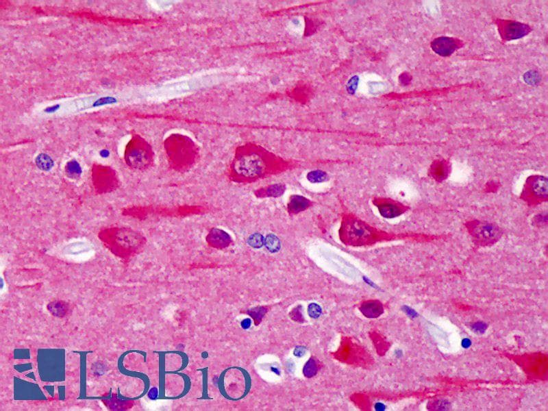 IHC-plus™ CAMK2 / CAMKII Antibody (phospho-Thr286)