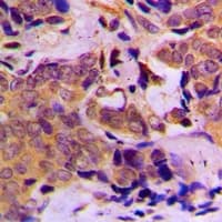 Polyclonal Rabbit anti-Human DOK1 Antibody (Internal, IHC, IF, WB)
