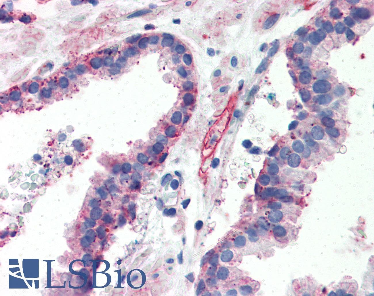 IHC-plus™ ITGB1 / Integrin Beta 1 / CD29 Antibody (clone HUTS-4)