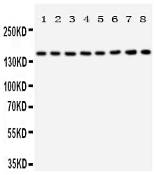 Polyclonal Rabbit anti-Human Hamartin / TSC1 Antibody (aa1150-1164, IHC, WB)