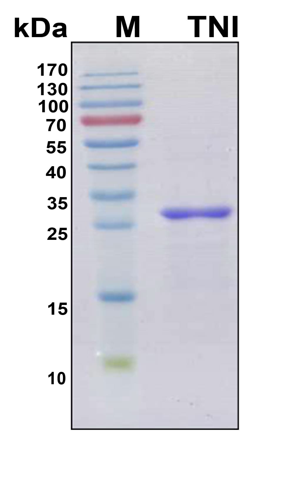 Human TNNI3 / Cardiac Troponin I Protein (Recombinant 6His, N-terminus)