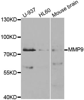 Polyclonal Rabbit anti-Human MMP9 / Gelatinase B Antibody (IHC, WB)