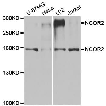 Polyclonal Rabbit anti-Human NCOR2 / SMRT Antibody (WB)
