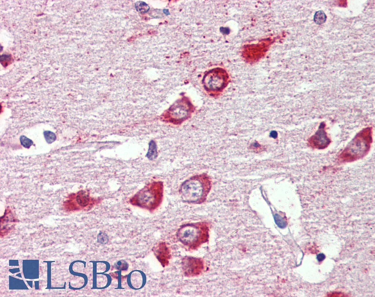 IHC-plus™ GABRA3 Antibody (aa480-492)