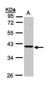 Polyclonal Rabbit anti-Human ASB4 Antibody (aa29-357, IHC, WB)