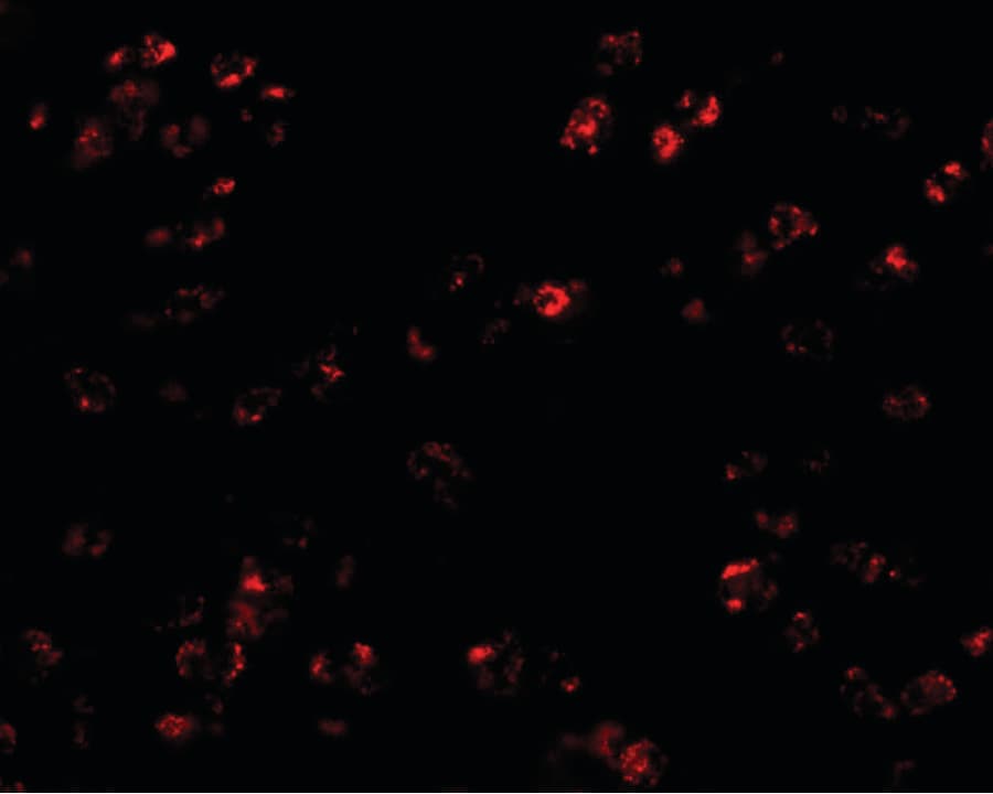 CCL17 / TARC Antibody