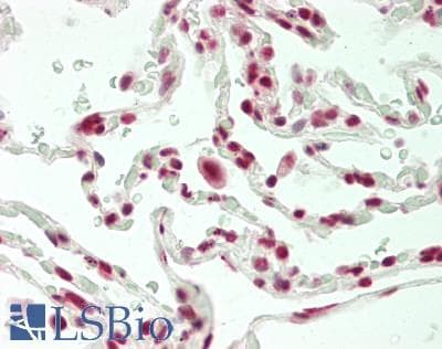 IHC-plus™ CPSF6 Antibody (aa501-551)