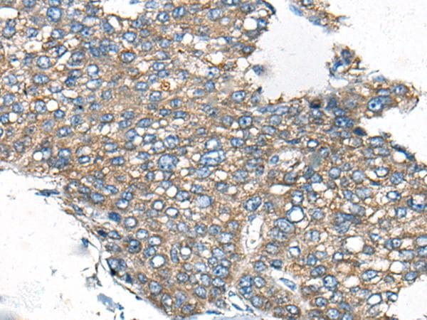 Polyclonal Rabbit anti-Human CDC42BPA / MRCK Antibody (IHC)