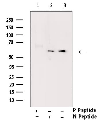 Polyclonal Rabbit anti-Human ESR2 / ER Beta Antibody (phospho-Ser105, IF, WB)