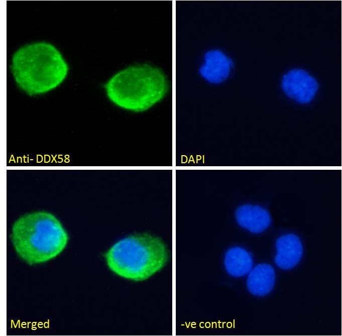 IHC-plus™ DDX58 / RIG-1 / RIG-I Antibody (C-Terminus)