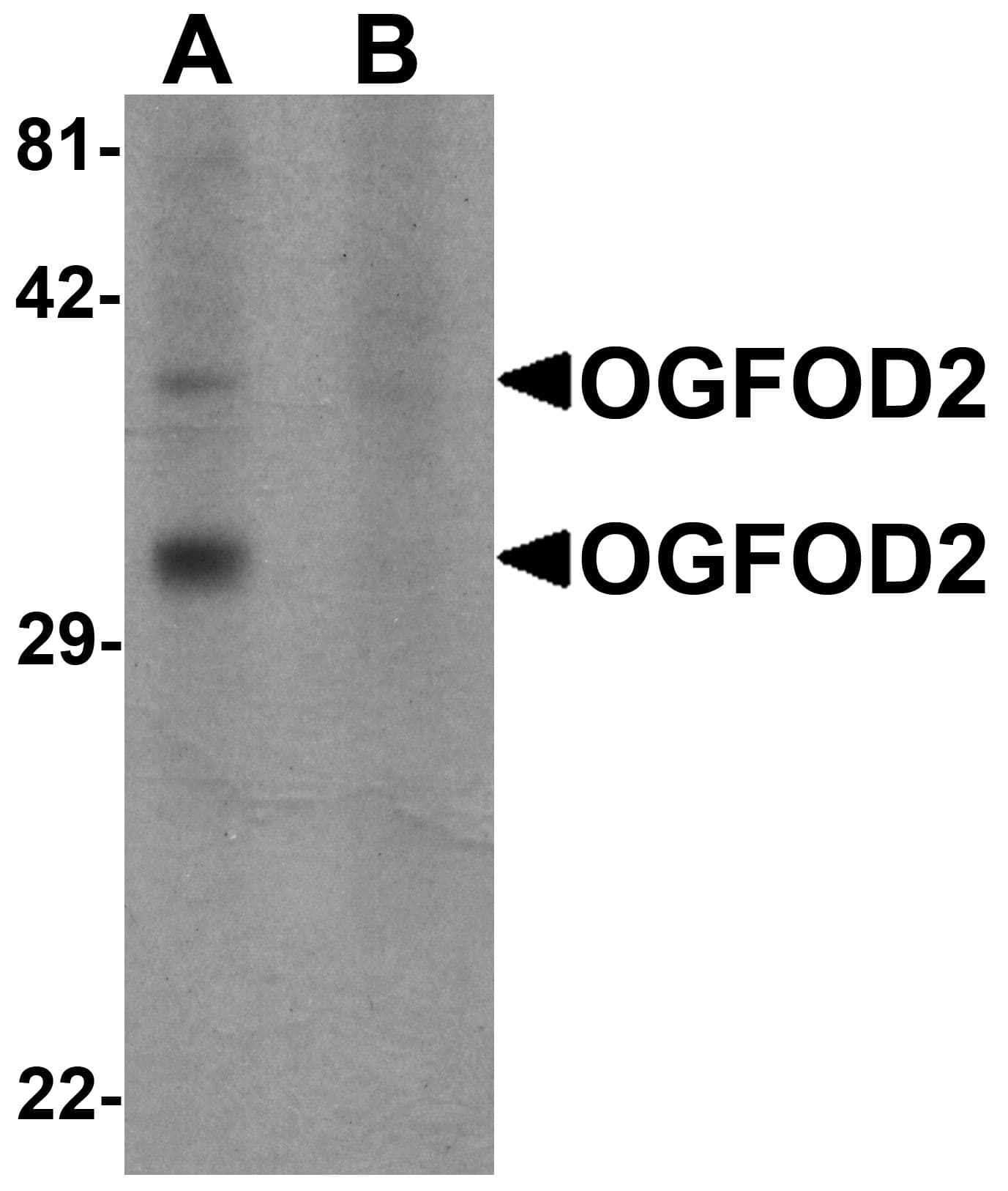 IHC-plus™ OGFOD2 Antibody