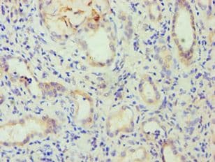 Polyclonal Rabbit anti-Human FKBP4 / FKBP52 Antibody (aa220-459, IHC, WB)