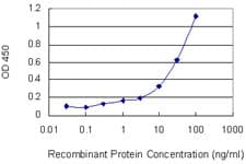 DCTN1 / Dynactin 1 Antibody (clone 1E12)