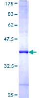 Human FBXL7 Protein (Recombinant GST, N-terminus)