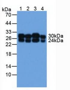COMT Antibody (aa52-271)