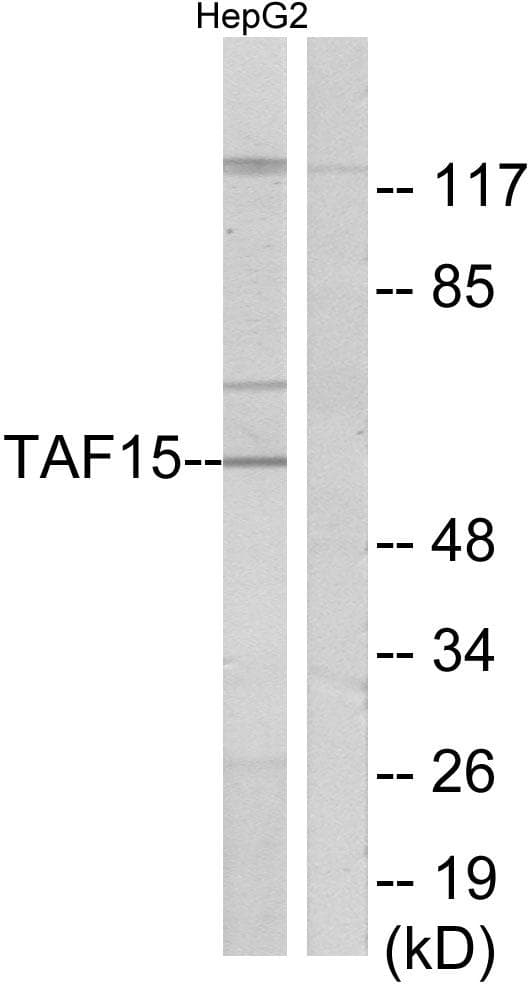 Polyclonal Rabbit anti-Human TAF15 Antibody (IHC, WB)