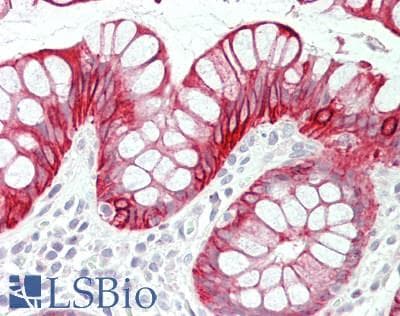 IHC-plus™ KRT8 / CK8 / Cytokeratin 8 Antibody (aa401-450)