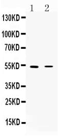Polyclonal Rabbit anti-Human CHRNA5 Antibody (IHC, WB)