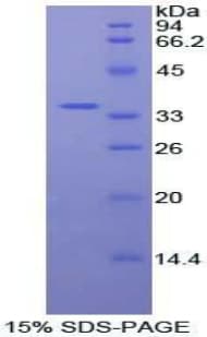 Human AKT2 Protein (Recombinant His-T7)