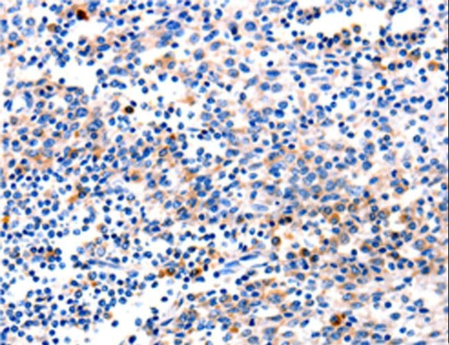 Polyclonal Rabbit anti-Human CR6 / GADD45G Antibody (IHC)