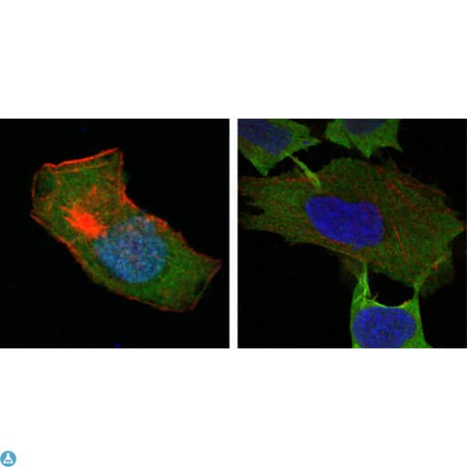 GSTP1 / GST Pi Antibody