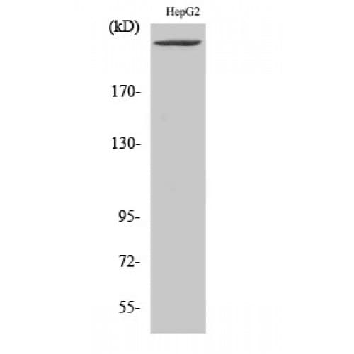 IHC-plus™ PIKFYVE / PIP5K Antibody (40-120 aa, N-terminal)