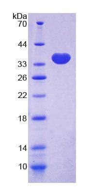 Human TLN2 / Talin 2 Protein (Recombinant His-T7)