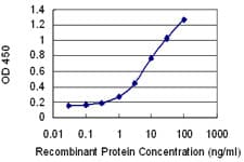 IL12B / IL12 p40 Antibody (clone 2H6)