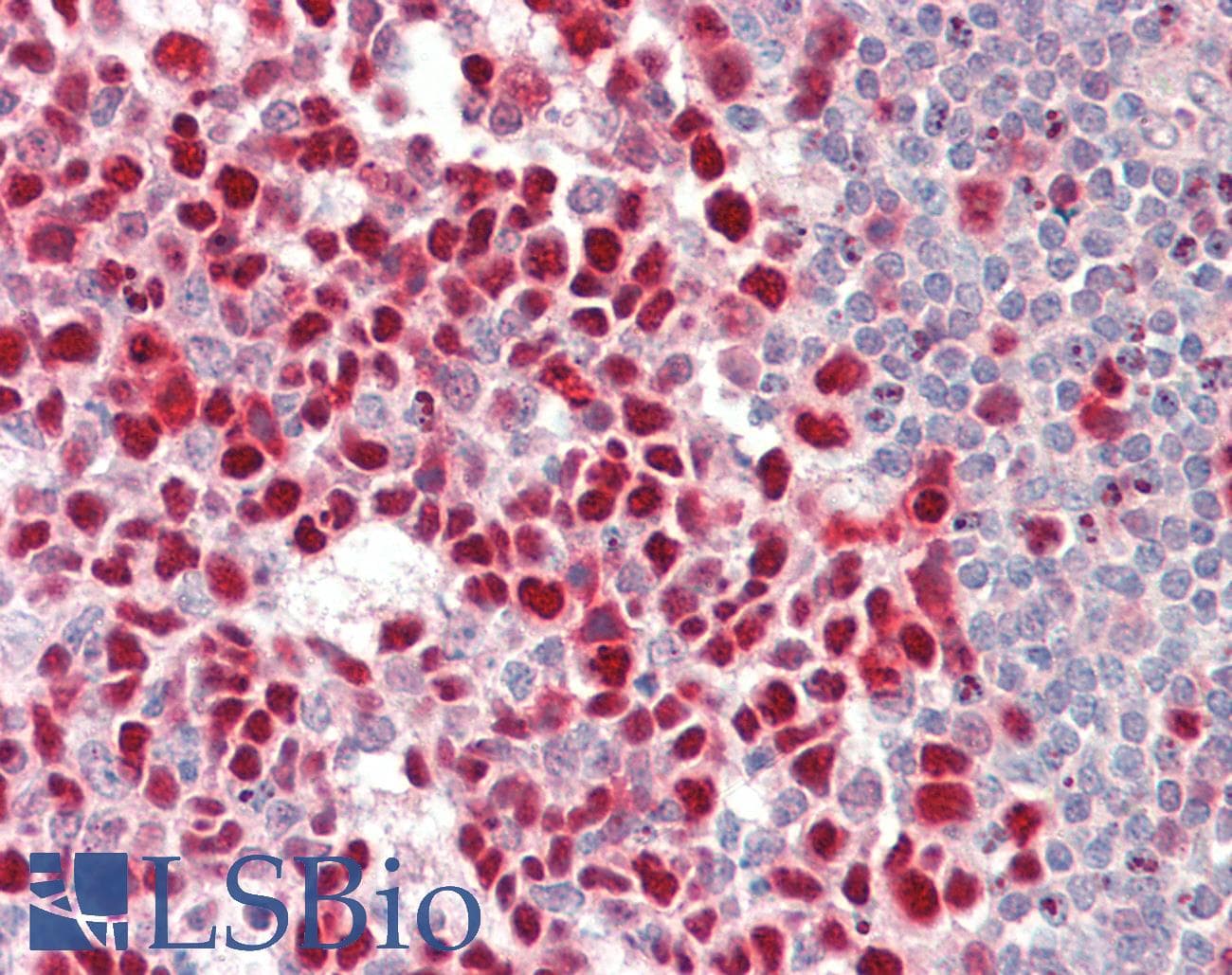 IHC-plus™ MCM2 Antibody (clone 2B3)