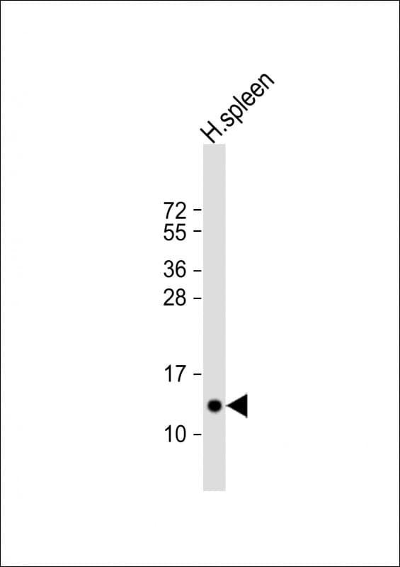 CXCL4 / PF4 Antibody (aa28-59)
