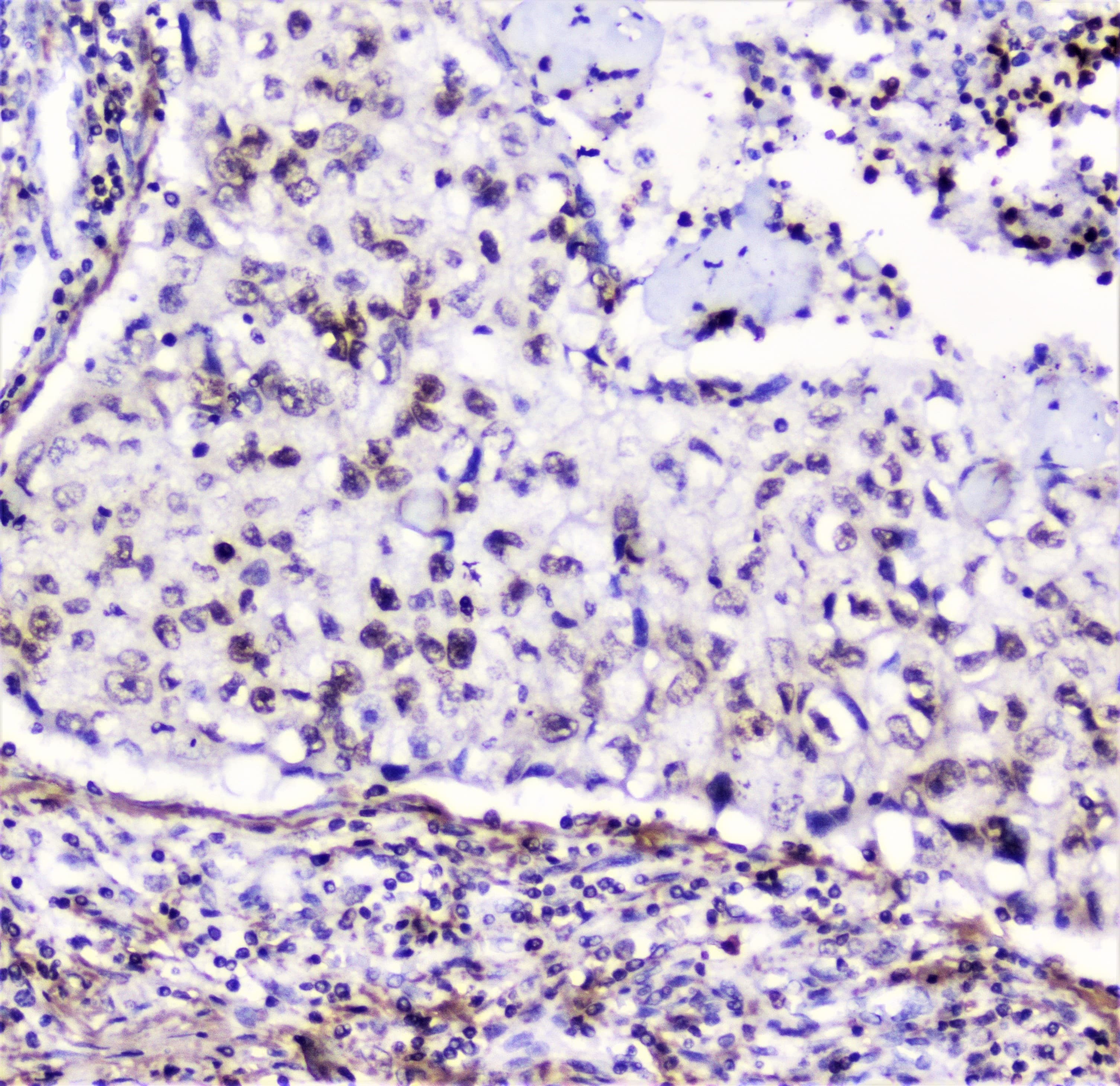 HMGN2 Antibody