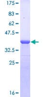 Human DMP1 Protein (Recombinant GST, N-terminus)