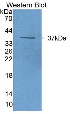 ALOX12B Antibody
