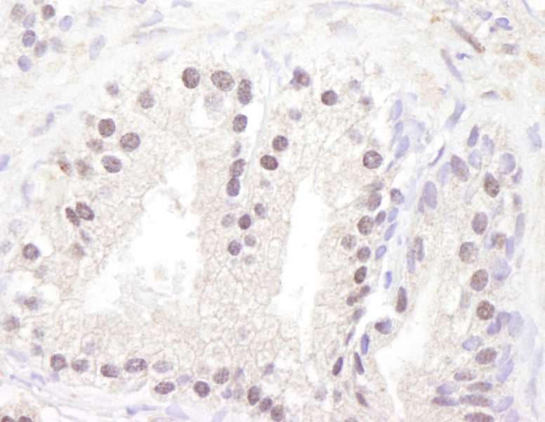 Polyclonal Rabbit anti-Human ATM Antibody (aa2550-2600, IHC, WB)