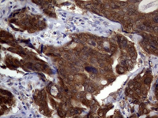 p16INK4a / CDKN2A Antibody (clone OTI10F12)