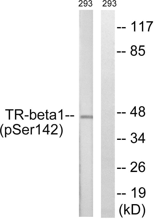 NR1A2 / THRB Antibody (phospho-Ser142)