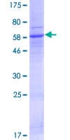 Human AWAT1 / DGAT2L3 Protein (Recombinant GST)