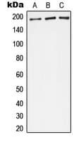 Complement C4c /C4b Antibody (Internal)