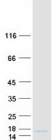 Human Osteocalcin Protein (Recombinant Myc-DDK (Flag))