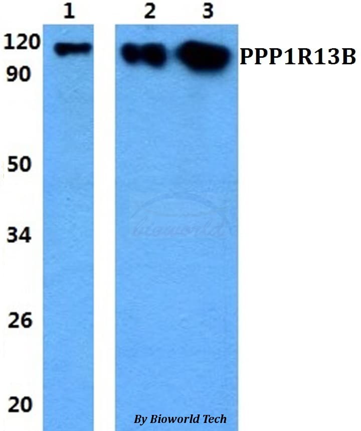 Polyclonal Rabbit anti-Human PPP1R13B Antibody (IHC, WB)