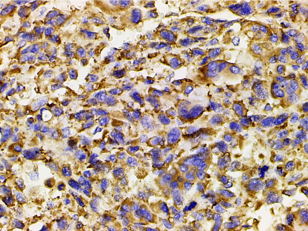 PIK3R1 / p85 Alpha Antibody (phospho-Tyr607)