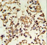 Polyclonal Rabbit anti-Human PRKACA + PRKACB Antibody (aa67-94, IHC, WB)